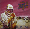 Leprosy